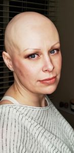 an image of a white woman in a light coloured striped shirt with a bald head looking into the camera. Melissa Holt, Yoga for Anxiety teacher